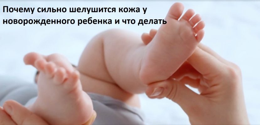 Почему сильно шелушится кожа у новорожденного ребенка и что делать?