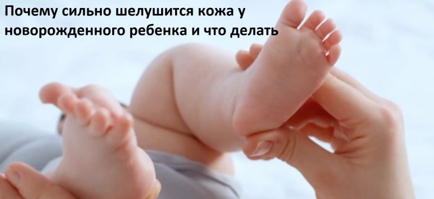 Почему сильно шелушится кожа у новорожденного ребенка и что делать?