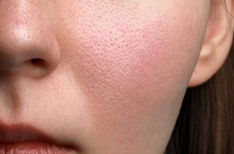 Как избавиться от ощущения стянутости кожи лица и тела в домашних условиях