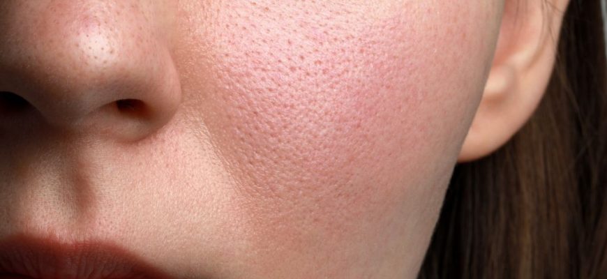 Как избавиться от ощущения стянутости кожи лица и тела в домашних условиях