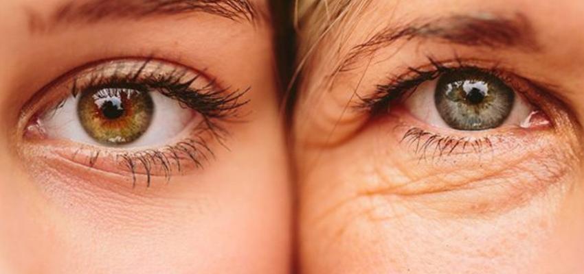 Как убрать морщины под глазами и вокруг глаз: топ-10 способов