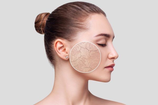 Топ-20 способов помочь сухой и обезвоженной коже