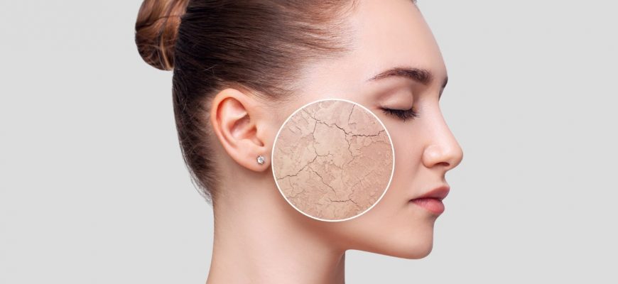 Топ-20 способов помочь сухой и обезвоженной коже