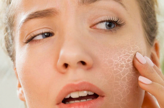 Почему сильно шелушится кожа и как этого избежать - инструкция