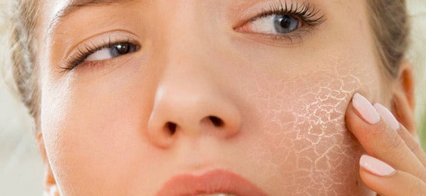 Почему сильно шелушится кожа и как этого избежать - инструкция