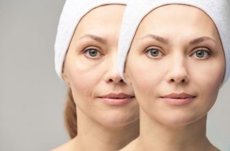 ТОП-10 способов: Как быстро убрать мешки под глазами и быстро снять отеки у женщин