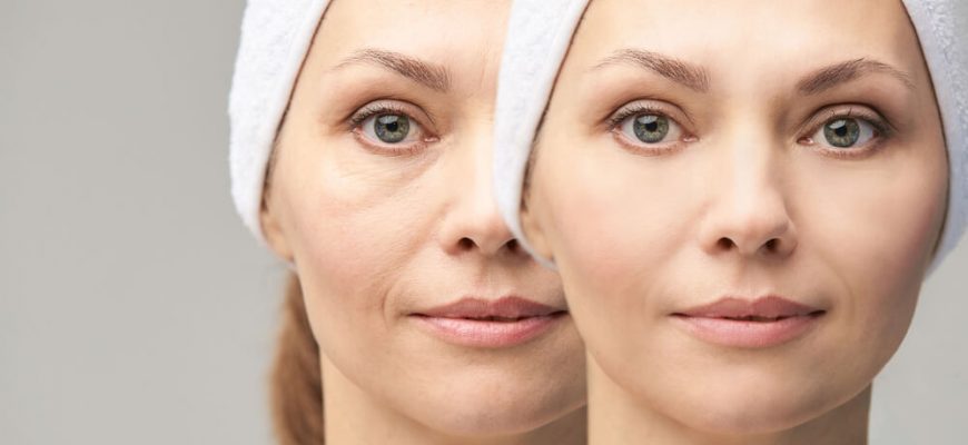 ТОП-10 способов: Как быстро убрать мешки под глазами и быстро снять отеки у женщин