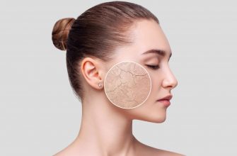 Как помочь обезвоженной коже и подобрать правильный уход